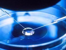 俄罗斯试管婴儿价格崇高孕妈妈，俄罗斯试管婴儿多少费用？